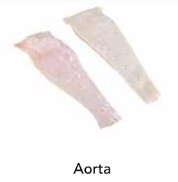 Aorta