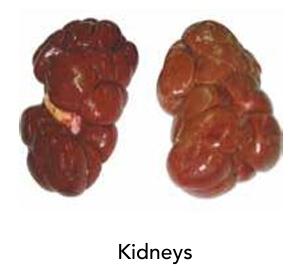 Kidneys